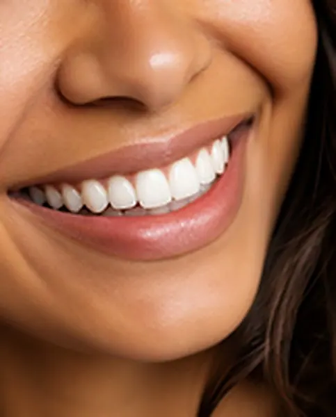 Close de um sorriso harmônico e natural